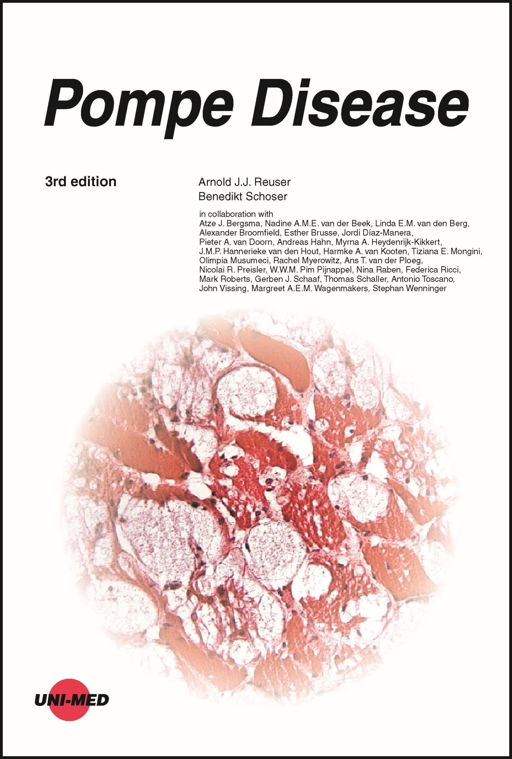 Cover: 9783837424331 | Pompe Disease | Arnold J. J. Reuser (u. a.) | Buch | UNI-MED Science