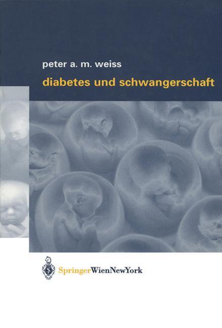 Cover: 9783709173954 | Diabetes und Schwangerschaft | Peter A. M. Weiss | Taschenbuch | XIII