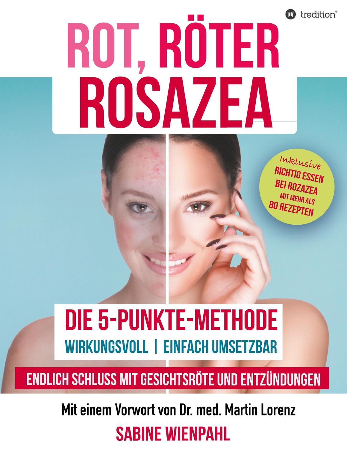 Cover: 9783746992839 | ROT RÖTER ROSAZEA | Sabine Wienpahl | Taschenbuch | tredition
