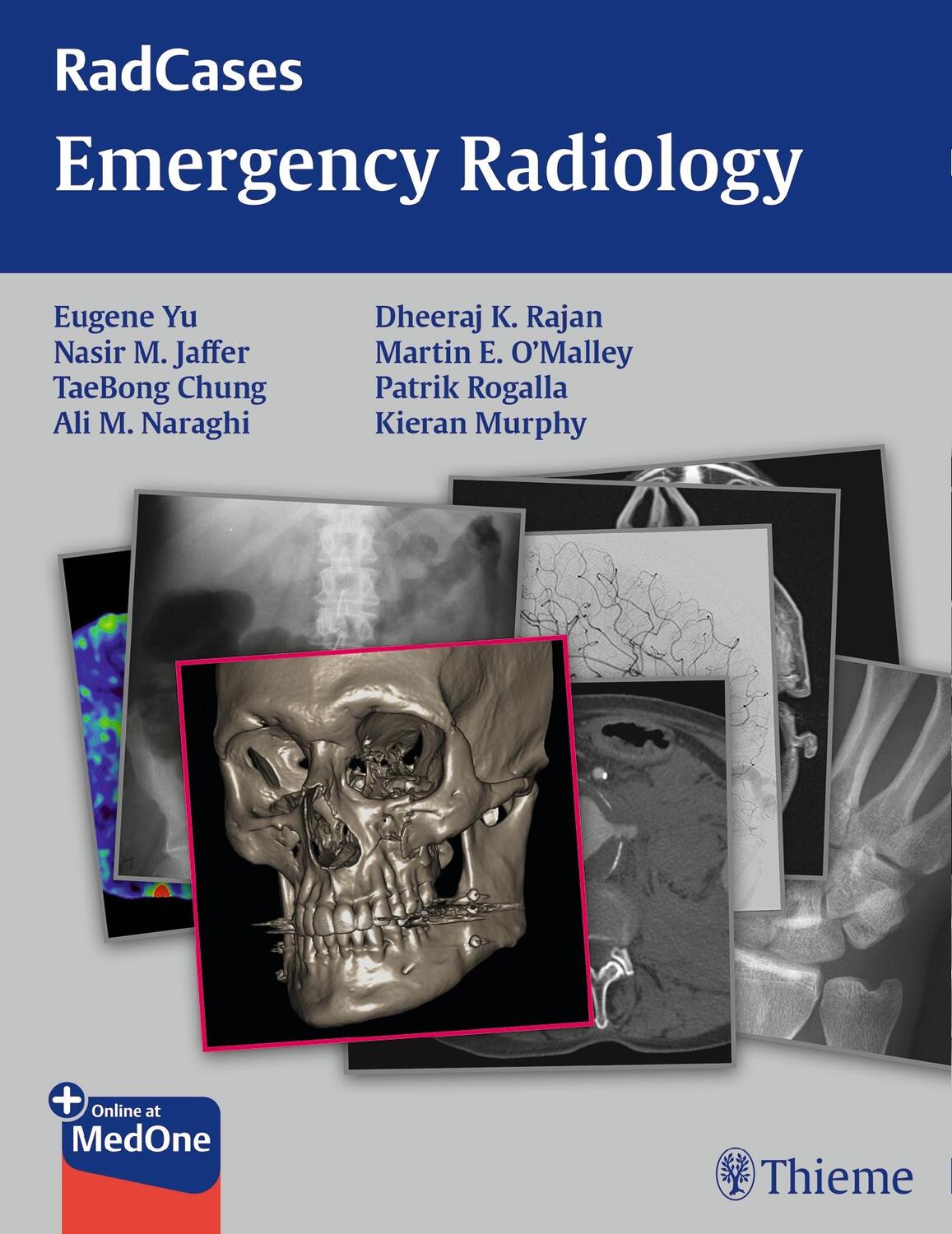 Cover: 9781604068320 | Radcases Emergency Radiology | Eugene Yu (u. a.) | Taschenbuch | 2015