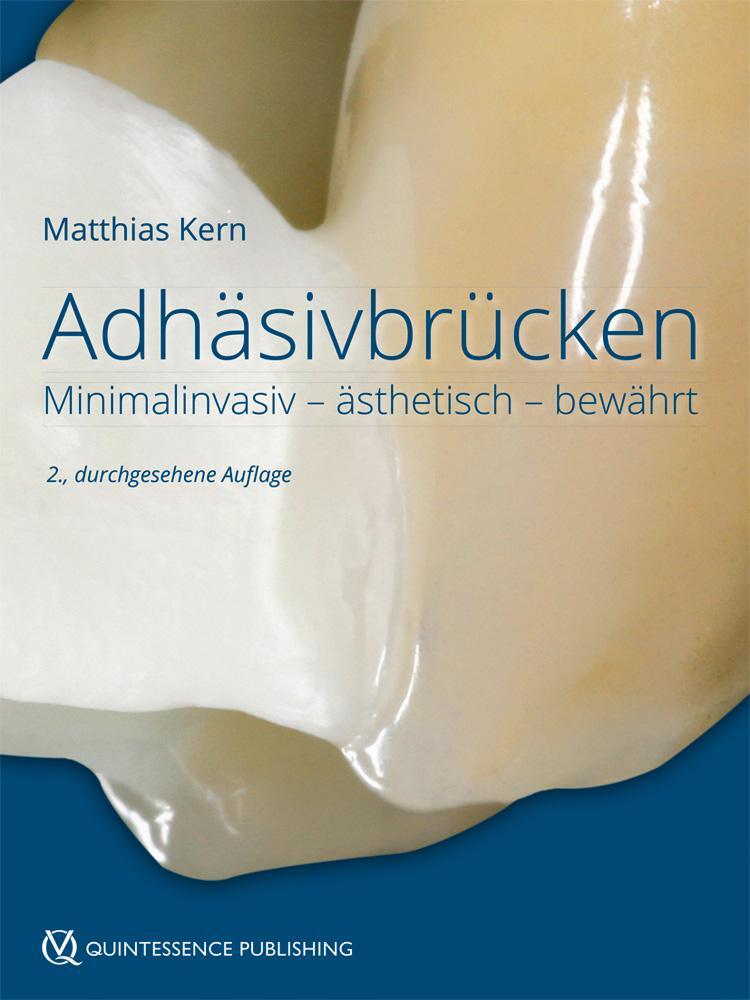 Cover: 9783868674125 | Adhäsivbrücken | Minimalinvasiv - ästhetisch - bewährt | Matthias Kern