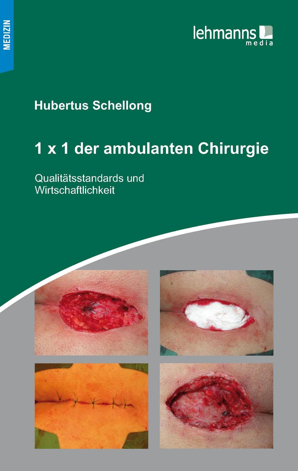 Cover: 9783965431409 | 1x1 der ambulanten Chirurgie | Hubertus Schellong | Taschenbuch | 2020