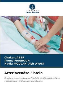 Cover: 9786205285107 | Arteriovenöse Fisteln | Chaker Jaber (u. a.) | Taschenbuch | Paperback