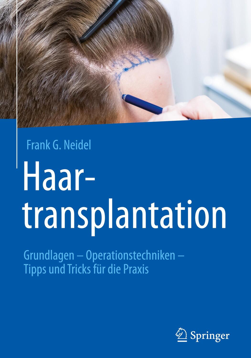 Cover: 9783662648520 | Haartransplantation | Frank G. Neidel | Buch | X | Deutsch | 2022