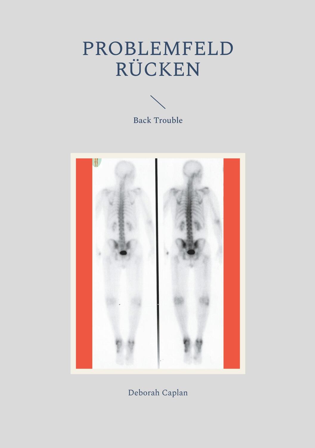Cover: 9783744829830 | PROBLEMFELD RÜCKEN | Back Trouble | Deborah Caplan | Taschenbuch