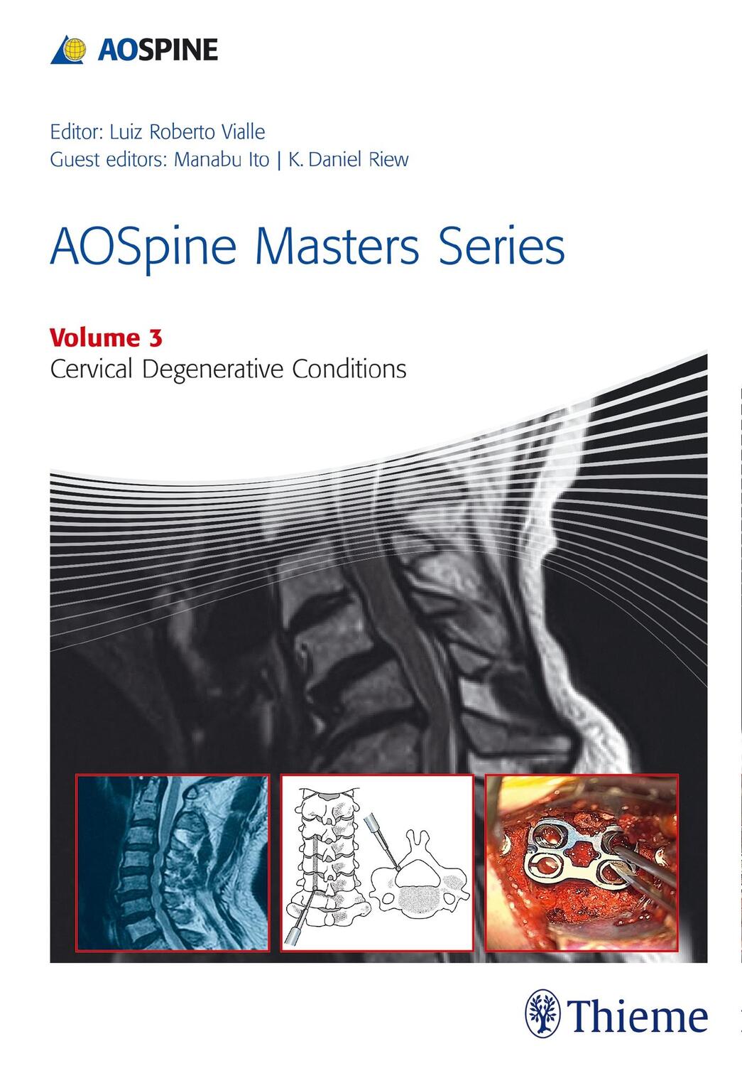 Cover: 9781626230507 | Aospine Masters Series Volume 3: Cervical Degenerative Conditions