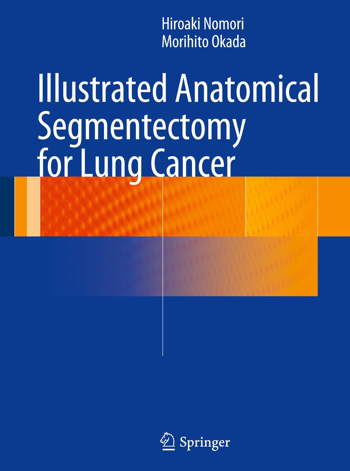 Cover: 9784431541431 | Illustrated Anatomical Segmentectomy for Lung Cancer | Okada (u. a.)