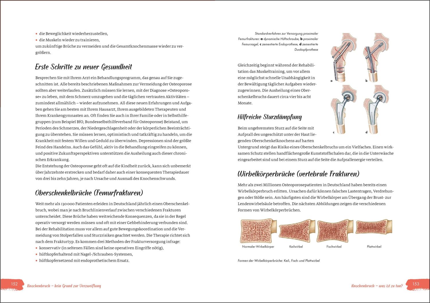 Bild: 9783517100746 | Power für die Knochen - Osteoporose vorbeugen, diagnostizieren,...