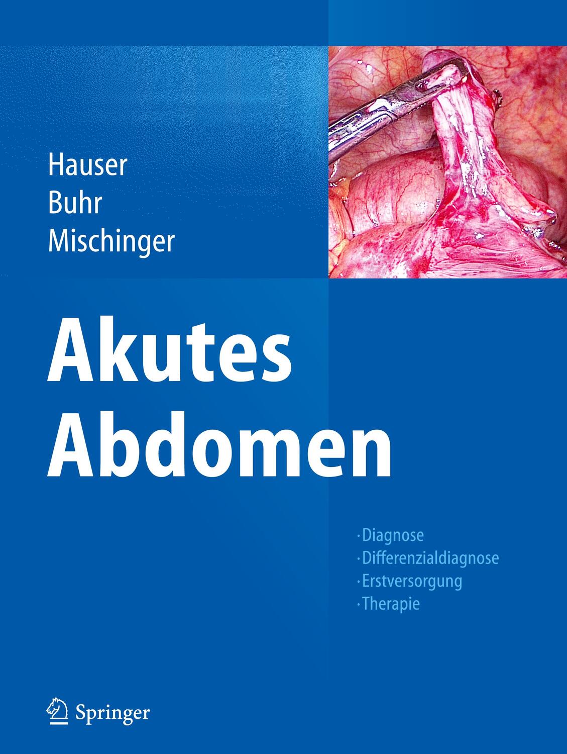 Cover: 9783709114728 | Akutes Abdomen | Hubert Hauser (u. a.) | Buch | Deutsch | 2016