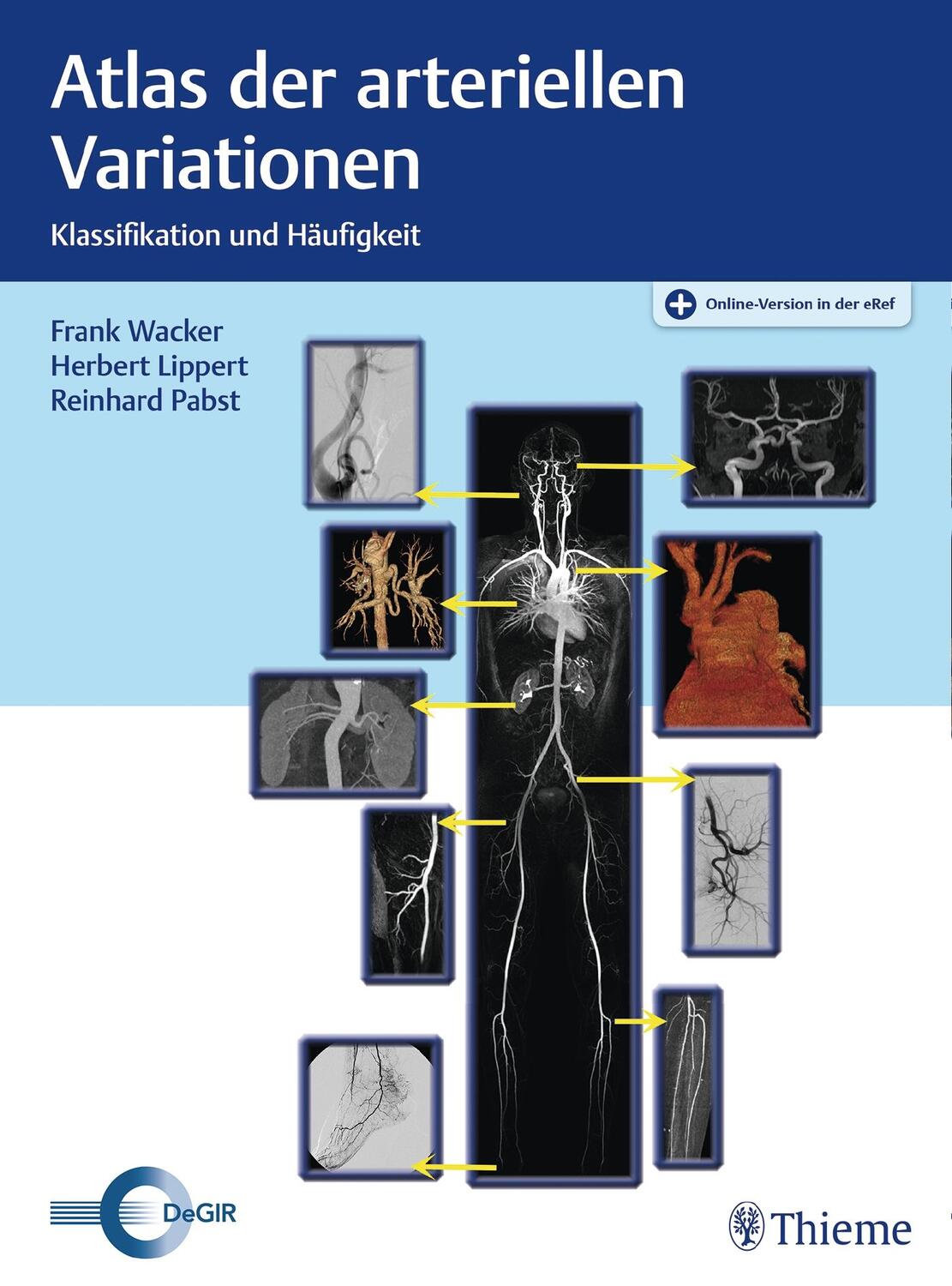 Cover: 9783131729613 | Atlas der arteriellen Variationen | Klassifikation und Häufigkeit