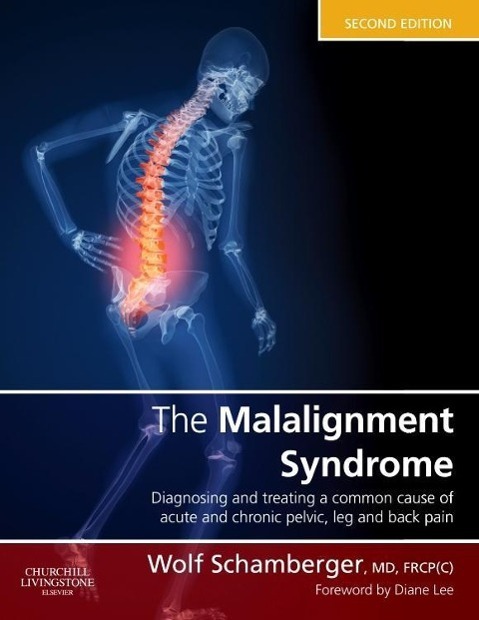 Cover: 9780443069291 | The Malalignment Syndrome | Wolf Schamberger | Buch | Gebunden | 2012
