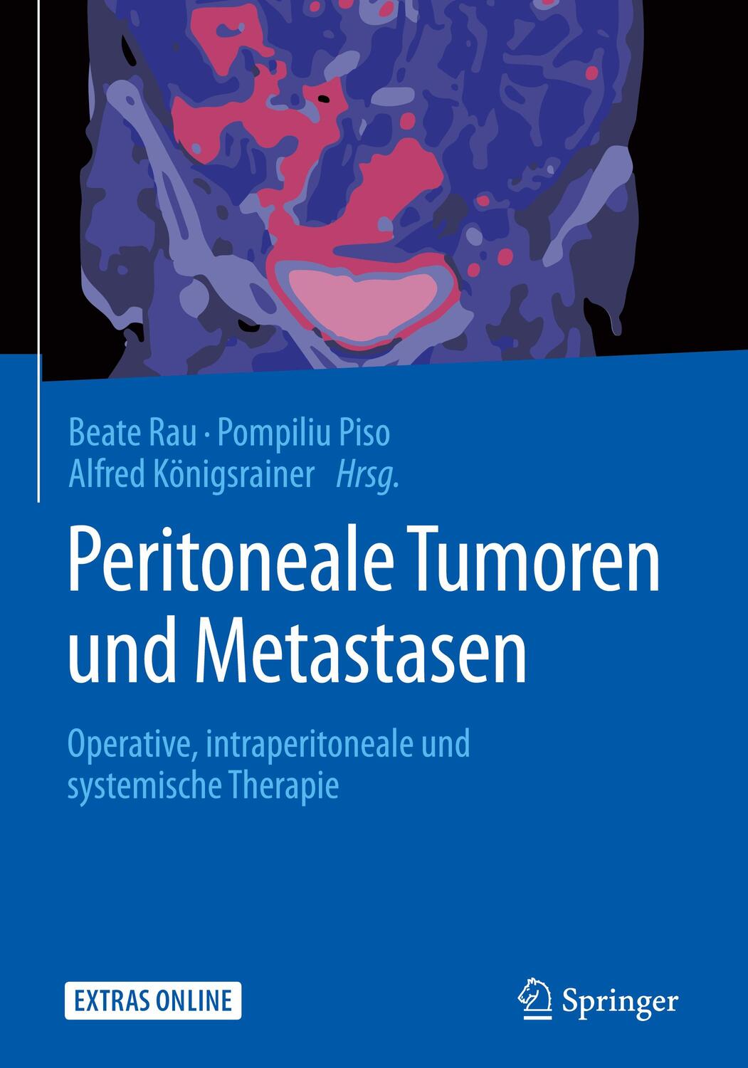 Cover: 9783662544990 | Peritoneale Tumoren und Metastasen | Beate Rau (u. a.) | Buch | XX