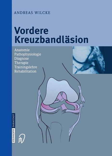 Cover: 9783798514041 | Vordere Kreuzbandläsion | Andreas Wilcke | Buch | XI | Deutsch | 2004