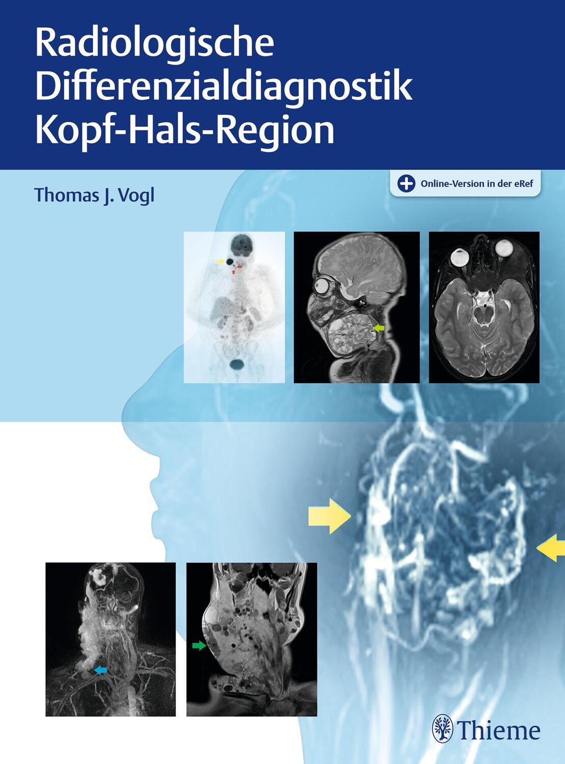 Cover: 9783132414891 | Radiologische Differenzialdiagnostik Kopf-Hals-Region | Thomas J. Vogl