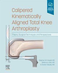 Cover: 9780323756266 | Calipered Kinematically Aligned Total Knee Arthroplasty | Buch | 2022