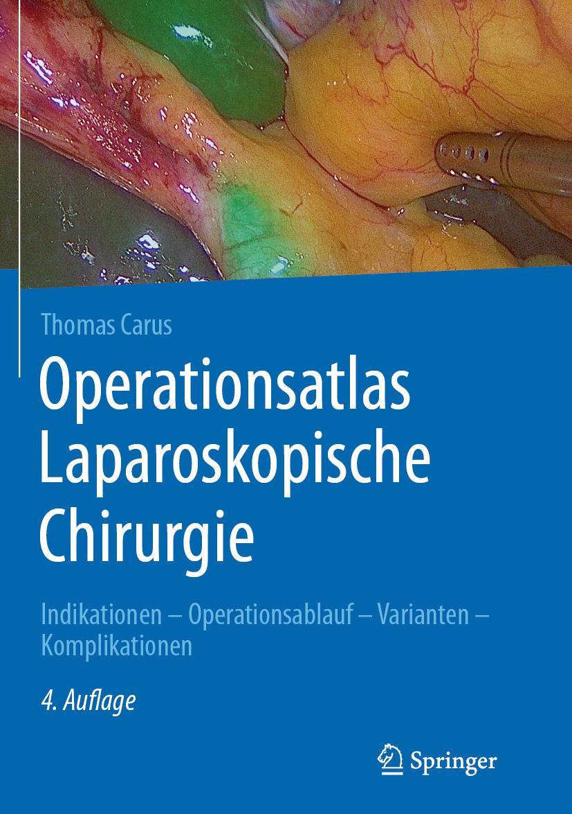 Cover: 9783662582381 | Operationsatlas Laparoskopische Chirurgie | Thomas Carus | Buch | xi