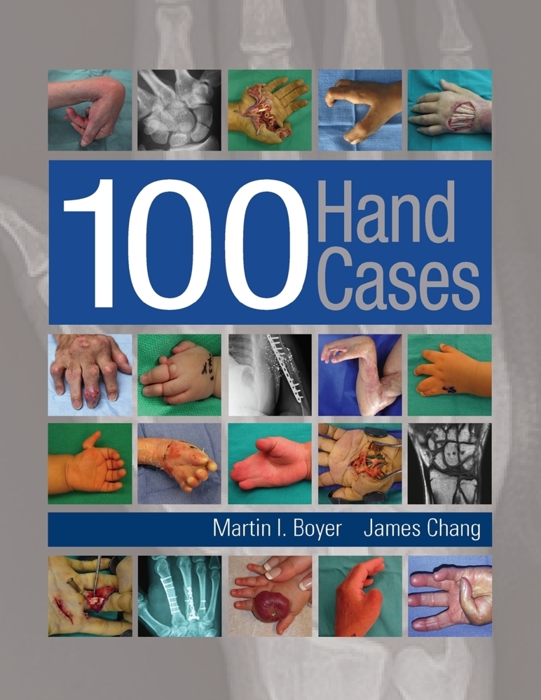 Cover: 9781626236608 | 100 Hand Cases | With online access | Martin Boyer (u. a.) | Bundle