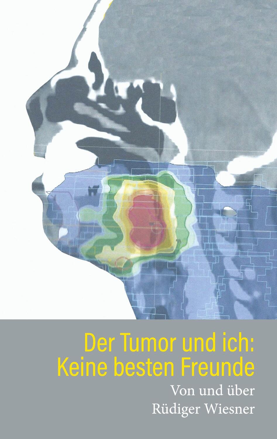 Cover: 9783754303443 | Der Tumor und Ich: Keine besten Freunde | Rüdiger Wiesner | Buch