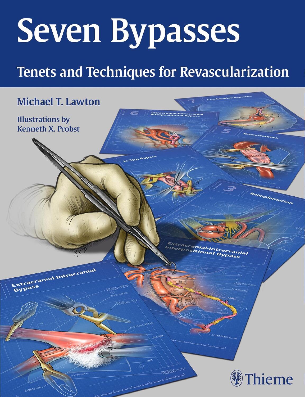 Cover: 9781626234833 | Seven Bypasses | Tenets and Techniques for Revascularization | Lawton