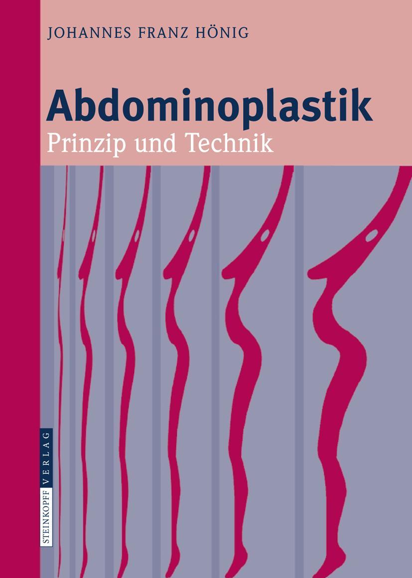 Cover: 9783798518162 | Abdominoplastik | Prinzip und Technik | Johannes-Franz Hönig | Buch