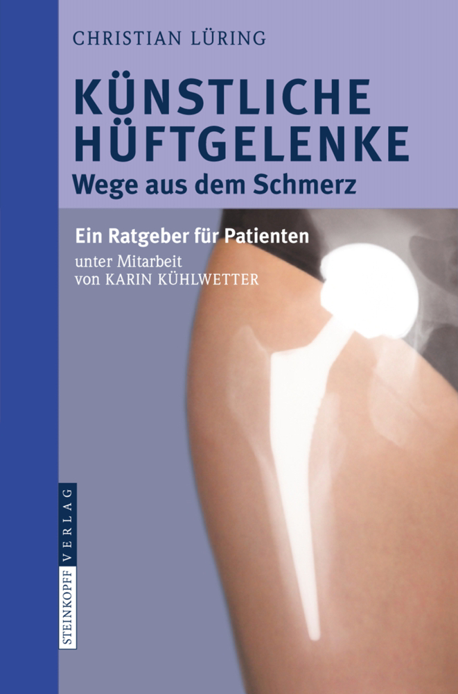 Cover: 9783798518919 | Künstliche Hüftgelenke | Christian Lüring | Taschenbuch | xii | 2009