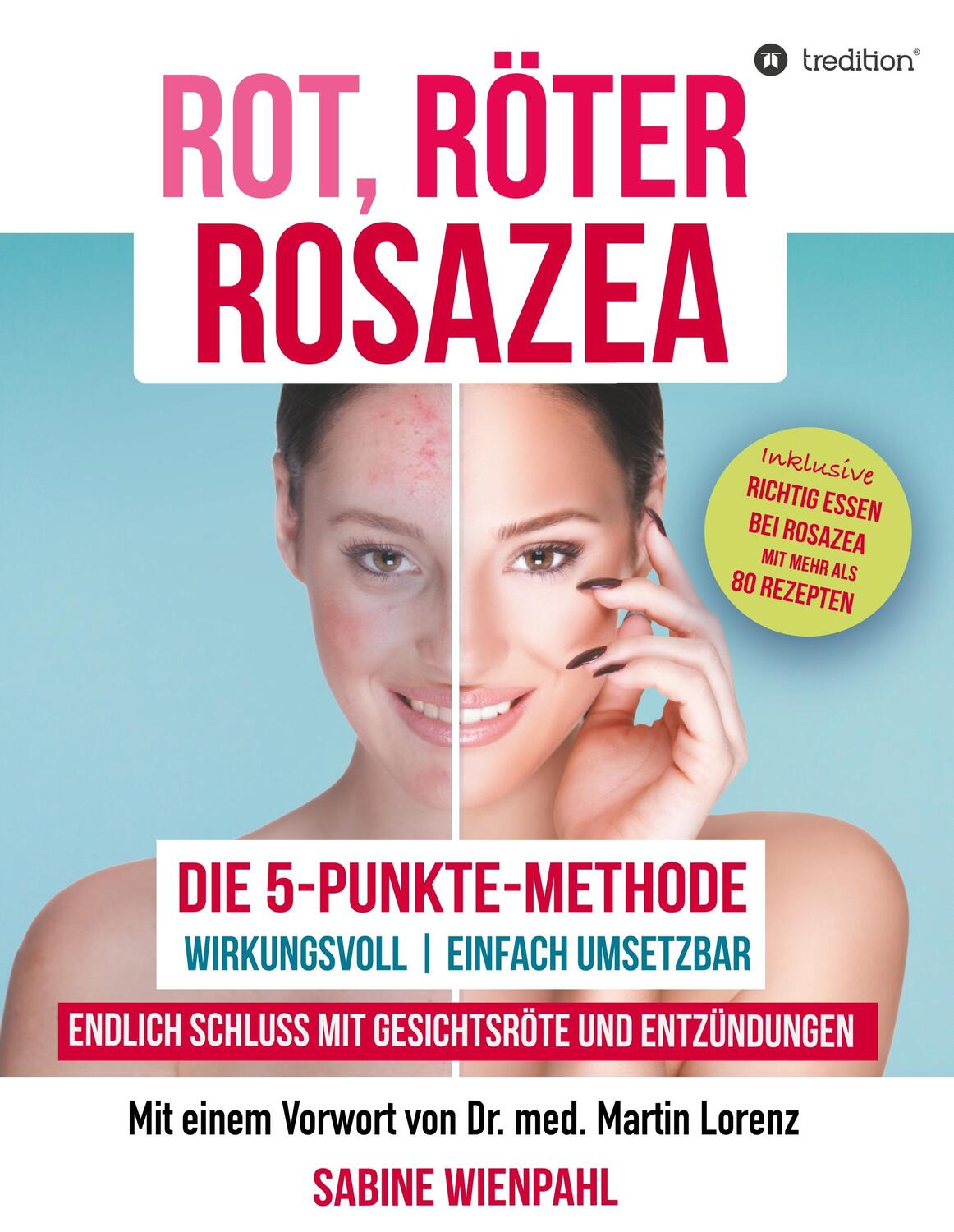Cover: 9783746992846 | ROT RÖTER ROSAZEA | Sabine Wienpahl | Buch | 236 S. | Deutsch | 2018