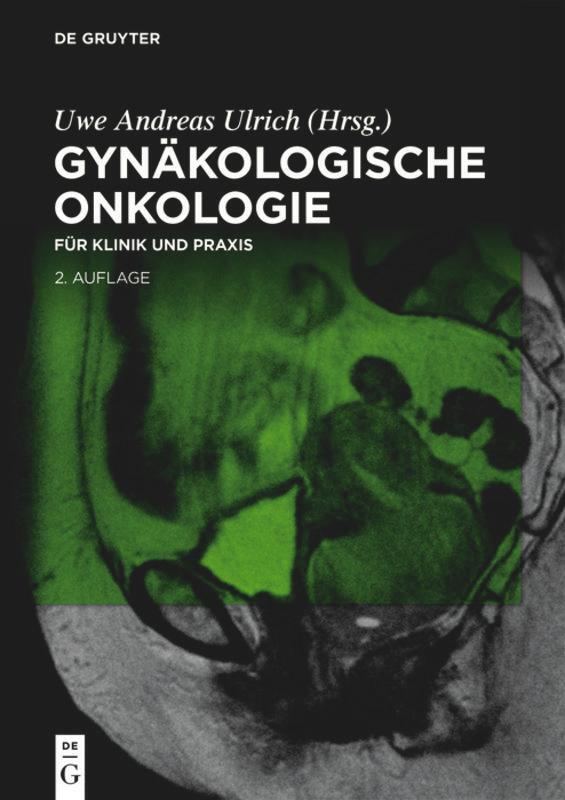 Cover: 9783110612615 | Gynäkologische Onkologie | für Klinik und Praxis | Uwe Andreas Ulrich
