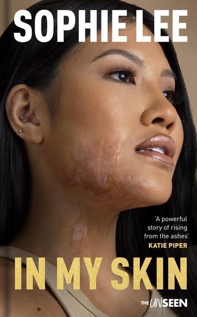 Cover: 9780281089406 | In My Skin | Learning to Love Your Perfectly Imperfect Life | Lee