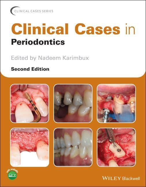 Cover: 9781119583950 | Clinical Cases in Periodontics | Nadeem Karimbux | Taschenbuch | 2022