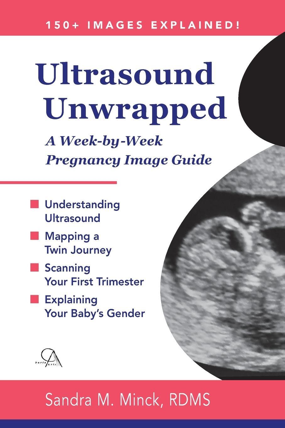 Cover: 9781638219330 | Ultrasound Unwrapped | A Week-by-Week Pregnancy Image Guide | RDMS