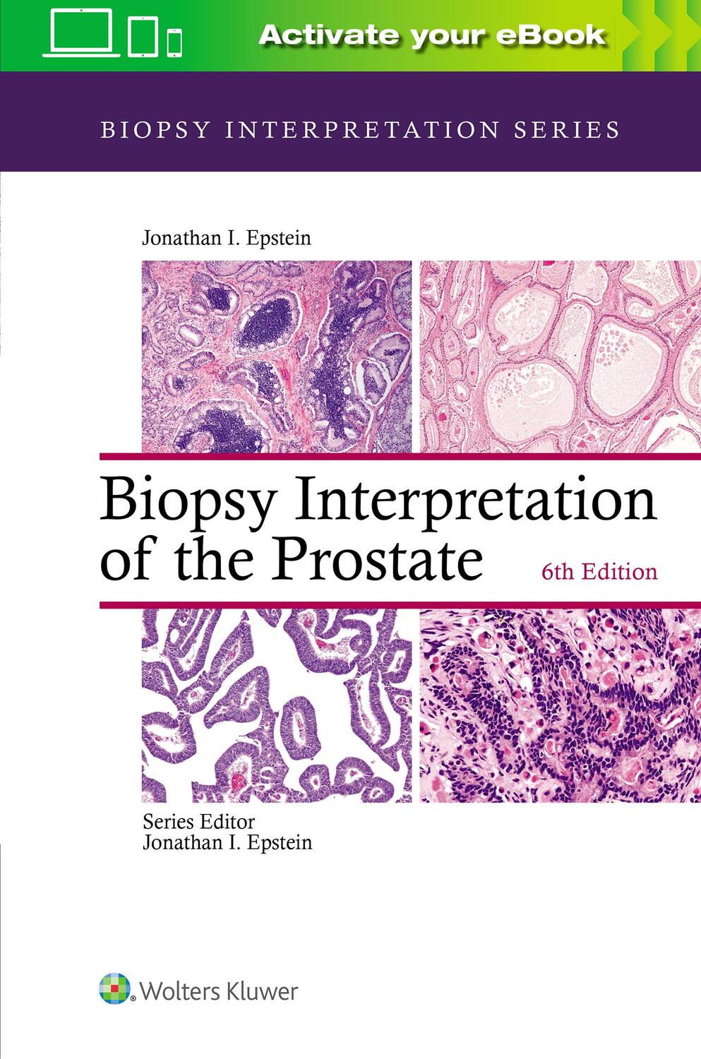 Cover: 9781975136543 | Biopsy Interpretation of the Prostate | Jonathan I. Epstein | Buch