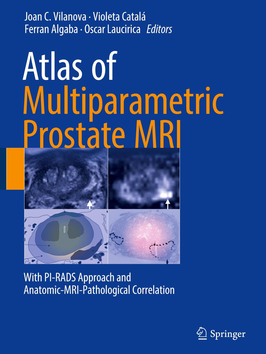 Cover: 9783319617855 | Atlas of Multiparametric Prostate MRI | Joan C. Vilanova (u. a.)