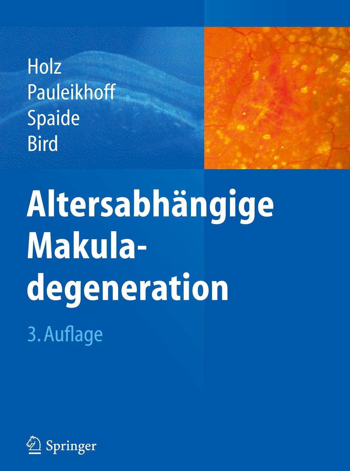 Cover: 9783642208690 | Altersabhängige Makuladegeneration | Frank G. Holz (u. a.) | Buch