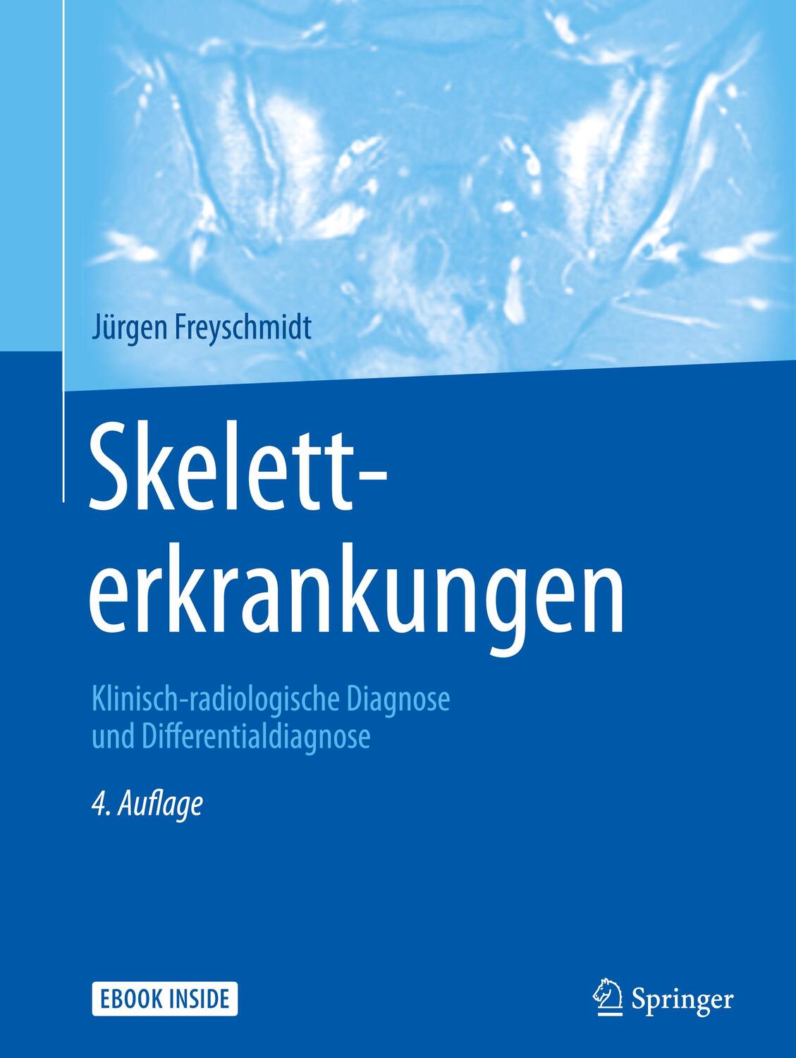 Cover: 9783662481363 | Skeletterkrankungen | Jürgen Freyschmidt | Buch | Deutsch | 2015