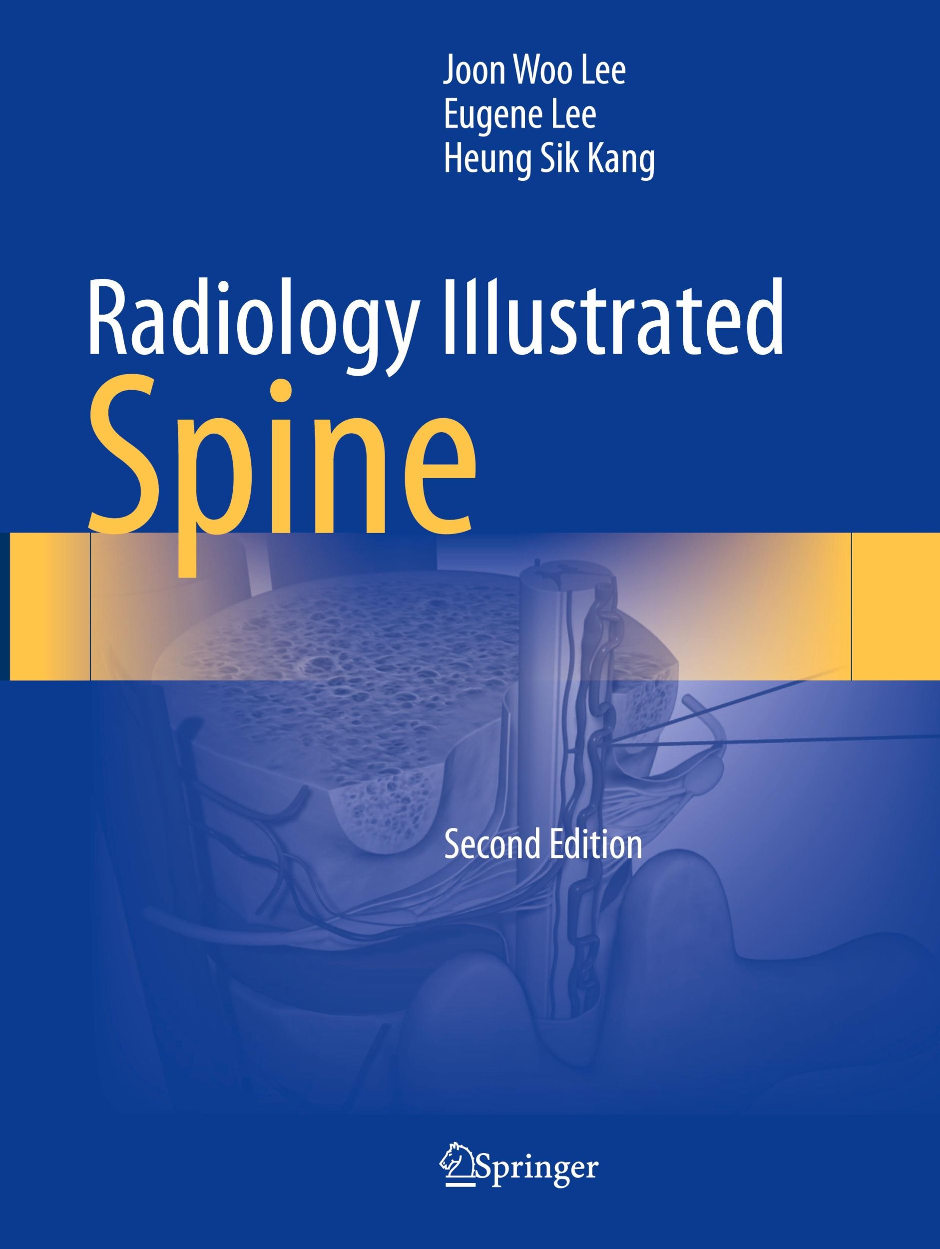 Cover: 9789819966141 | Radiology Illustrated: Spine | Joon Woo Lee (u. a.) | Taschenbuch