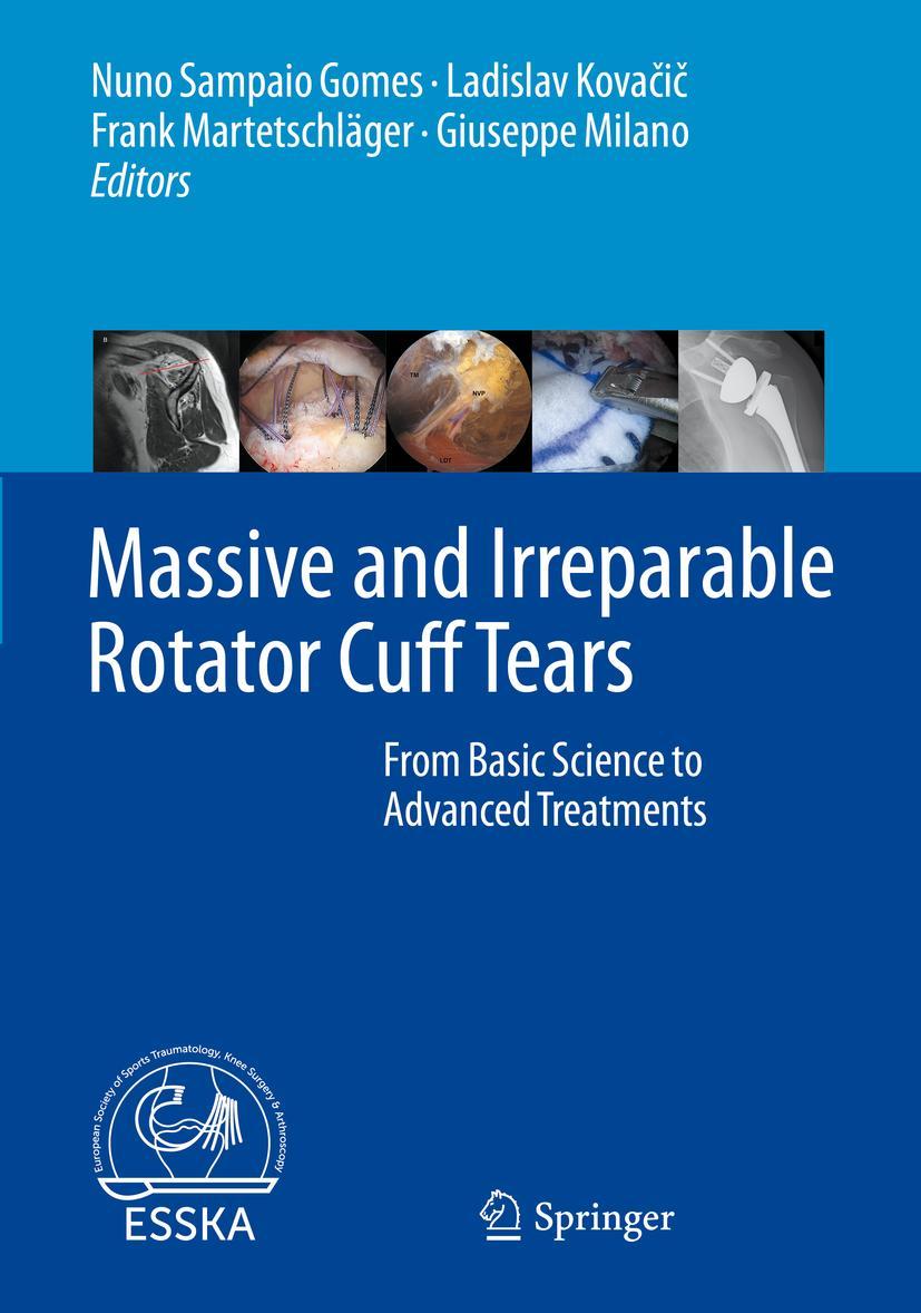 Cover: 9783662611616 | Massive and Irreparable Rotator Cuff Tears | Gomes (u. a.) | Buch