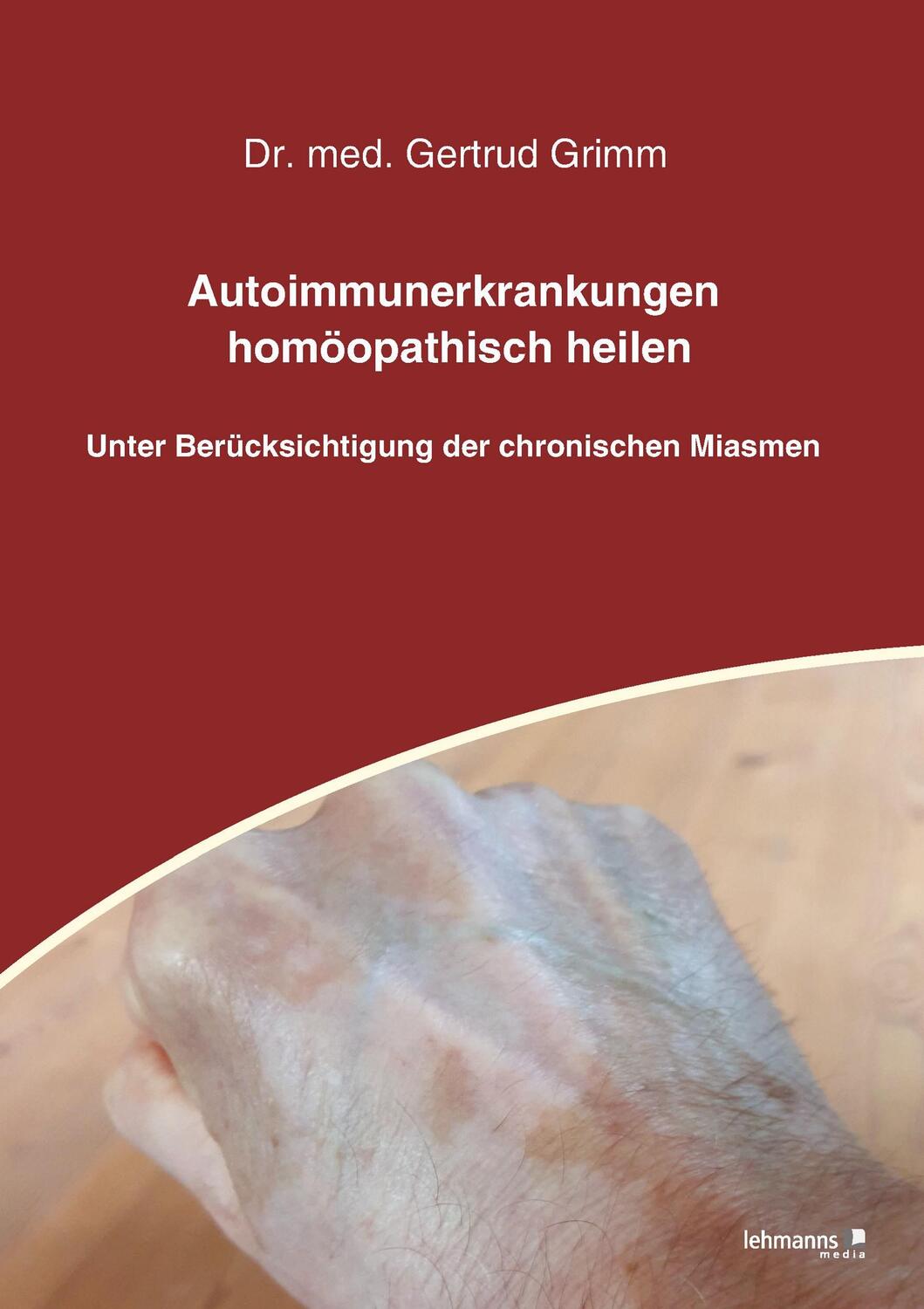 Cover: 9783965431478 | Autoimmunerkrankungen homöopathisch heilen | Gertrud Grimm | Buch