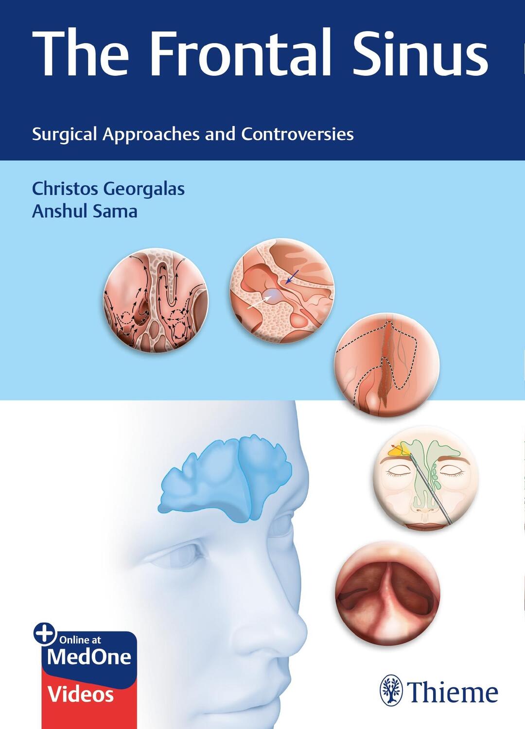 Cover: 9783132400528 | The Frontal Sinus | Surgical Approaches and Controversies | Bundle