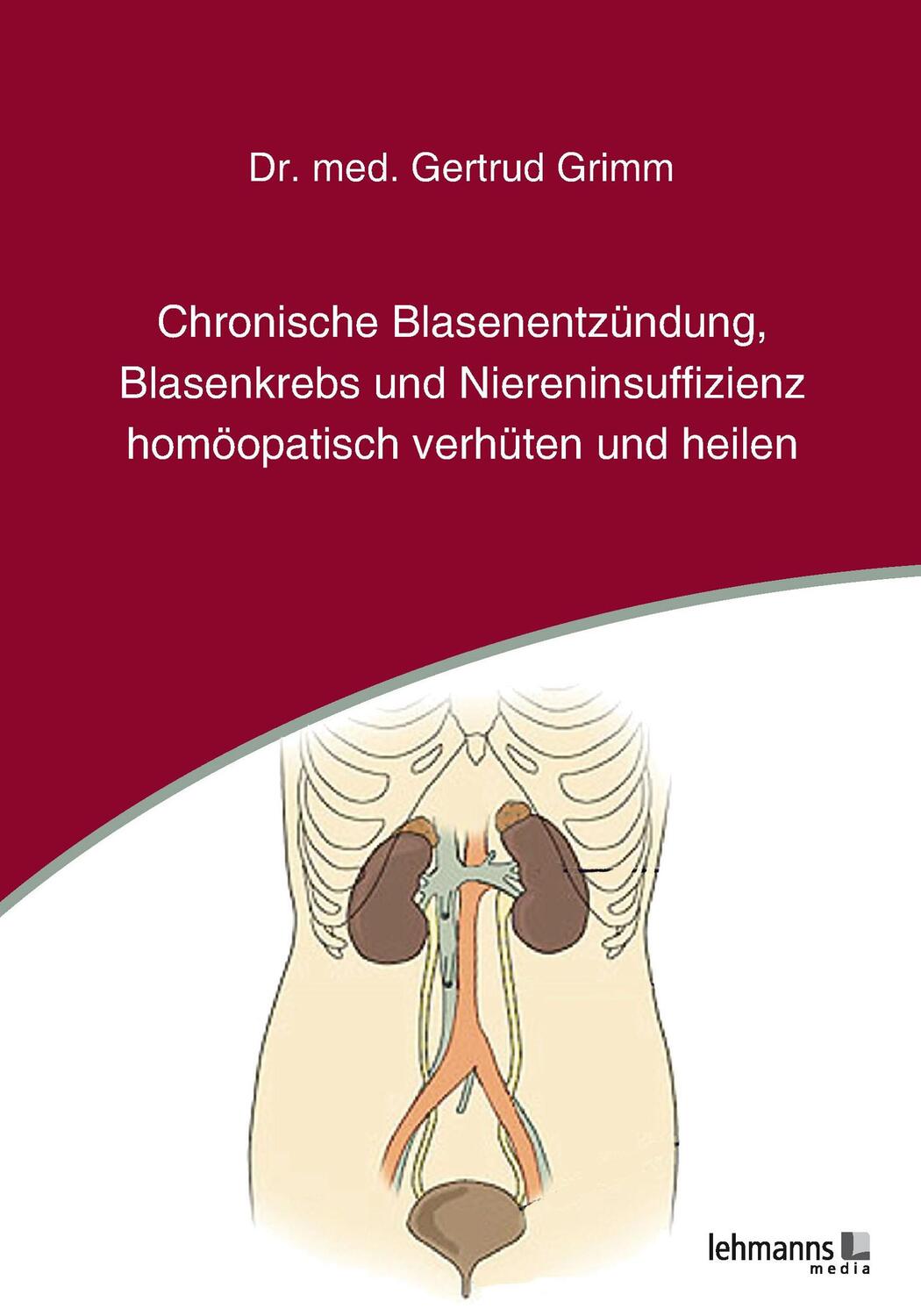 Cover: 9783965431010 | Chronische Blasenentzündung, Blasenkrebs und Niereninsuffizienz -...