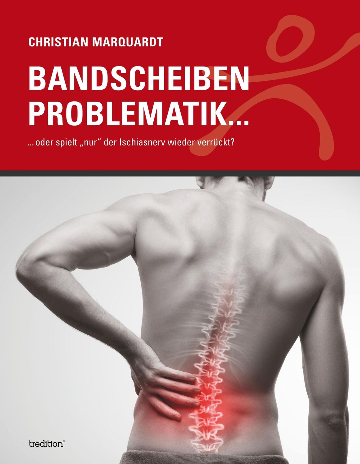 Cover: 9783748243205 | Bandscheiben Problematik | Christian Marquardt | Buch | 104 S. | 2019