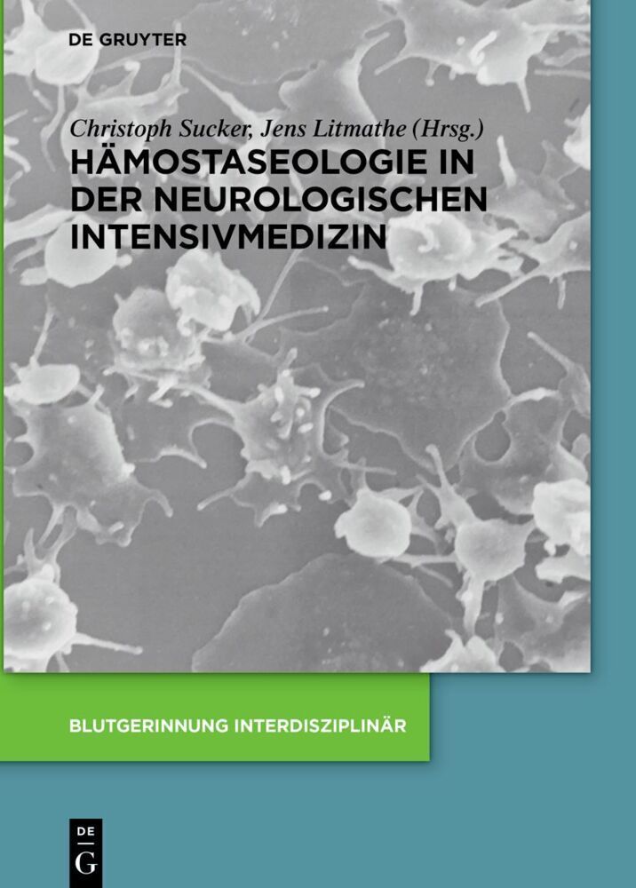 Cover: 9783110490985 | Hämostaseologie in der neurologischen Intensivmedizin | Sucker (u. a.)