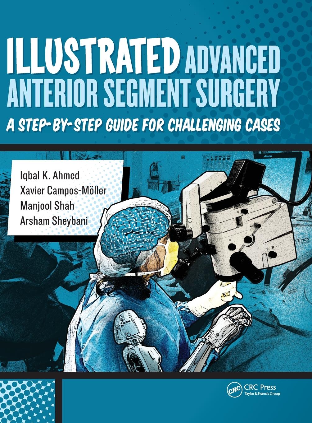 Cover: 9781630911843 | Illustrated Advanced Anterior Segment Surgery | Iqbal Ahmed (u. a.)