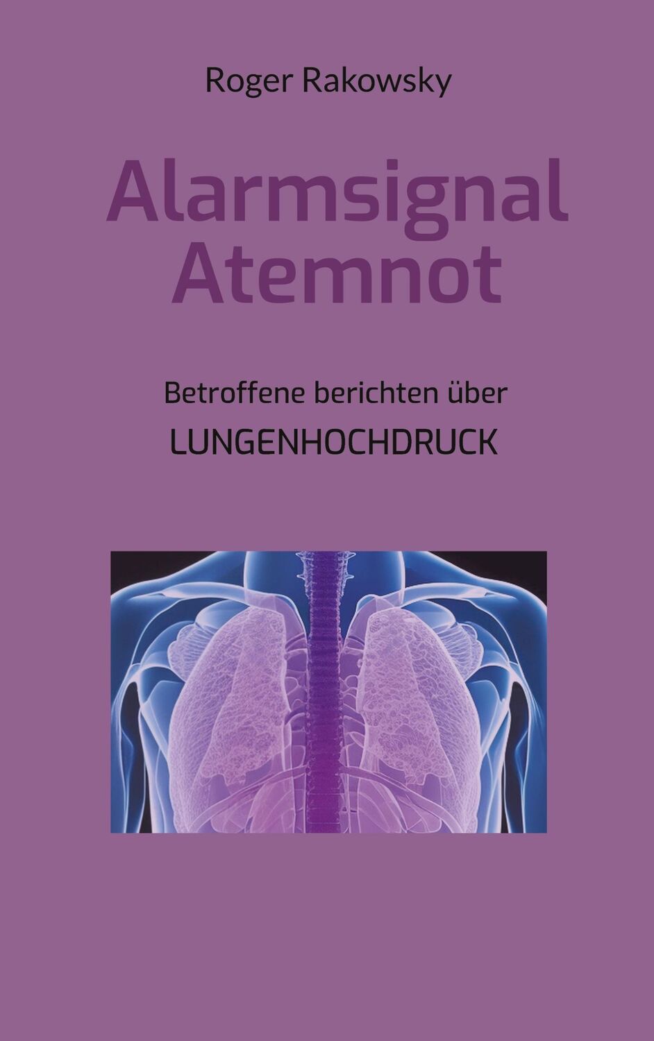 Cover: 9783757878658 | Alarmsignal Atemnot | Betroffene berichten über Lungenhochdruck | Buch