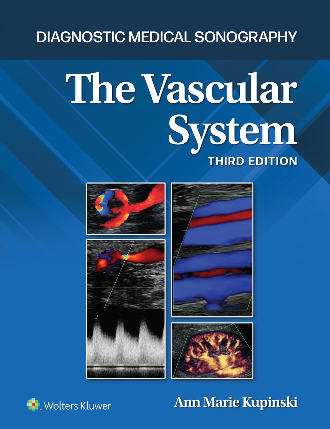 Cover: 9781975175269 | The Vascular System | Ann Marie, PhD, RVT Kupinski | Buch | Englisch
