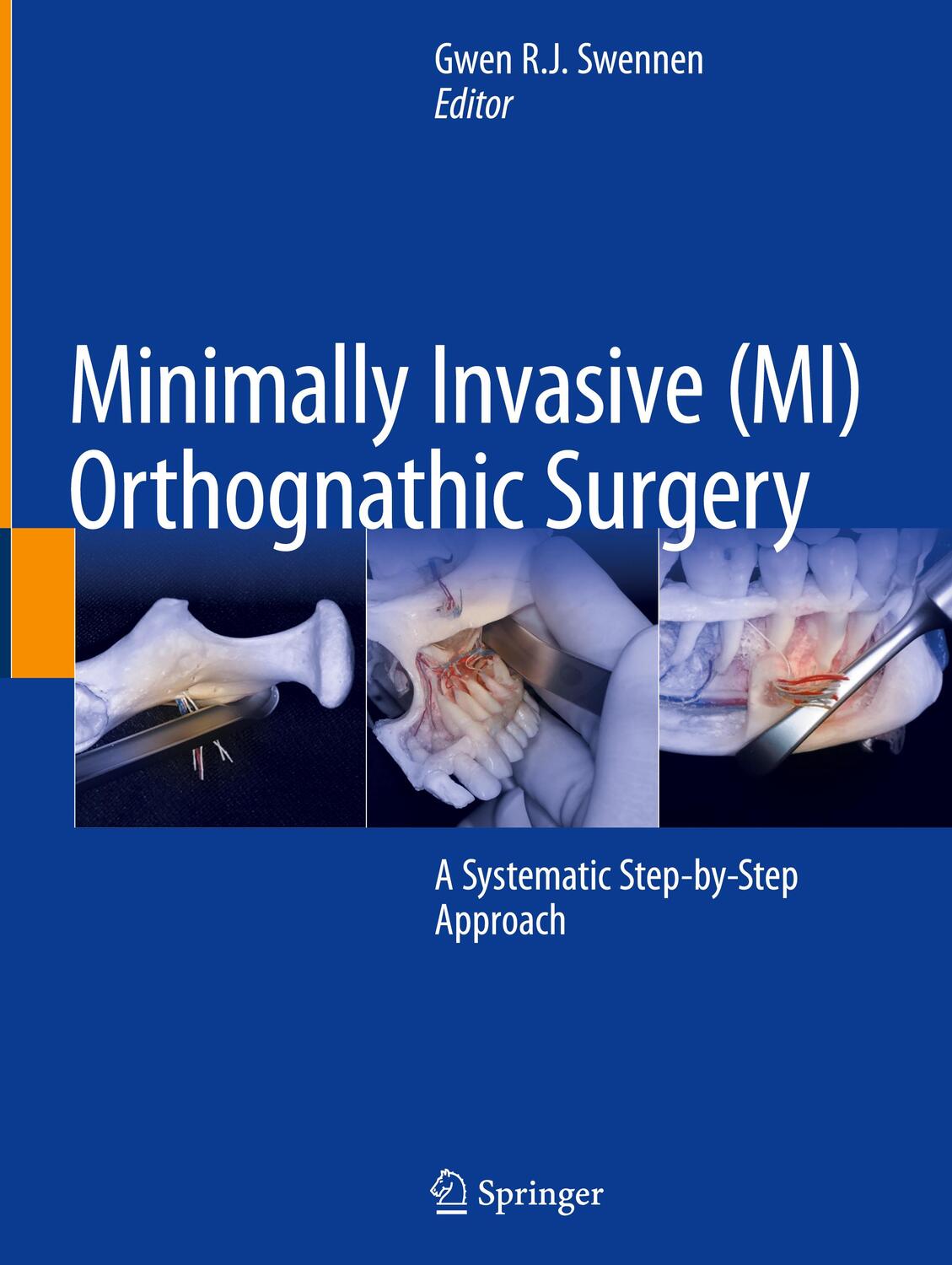 Cover: 9783031380112 | Minimally Invasive (MI) Orthognathic Surgery | Gwen R. J. Swennen