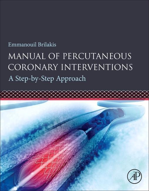 Cover: 9780128193679 | Manual of Percutaneous Coronary Interventions: A Step-By-Step Approach