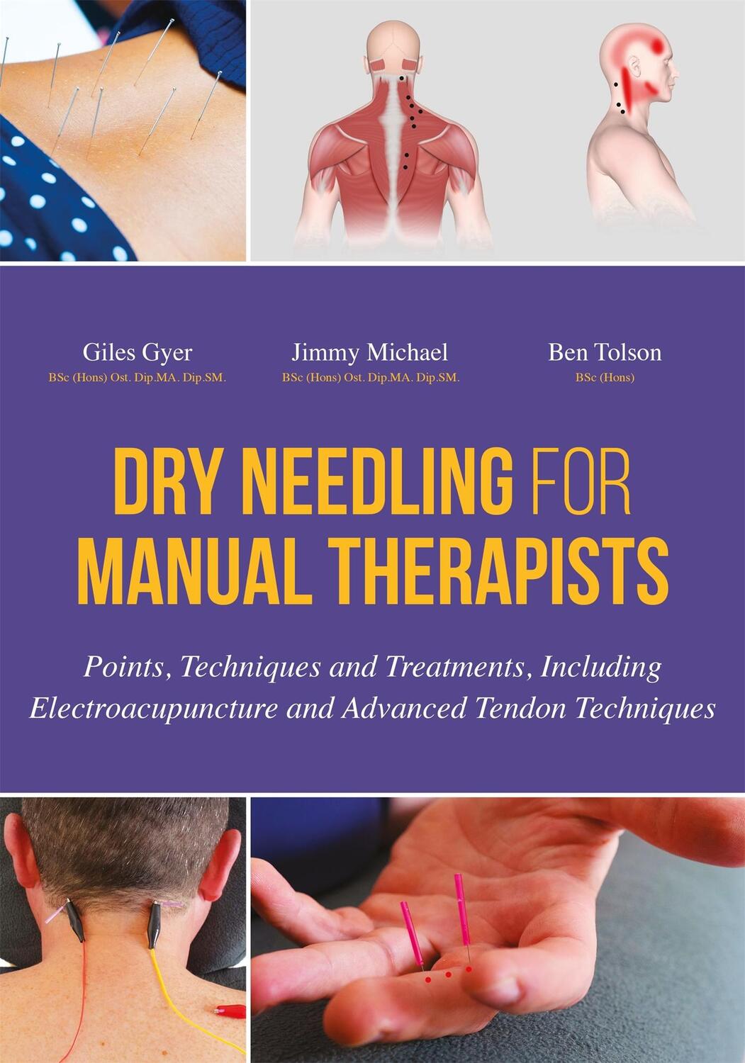 Cover: 9781848192553 | Dry Needling for Manual Therapists | Ben Tolson (u. a.) | Buch | 2016