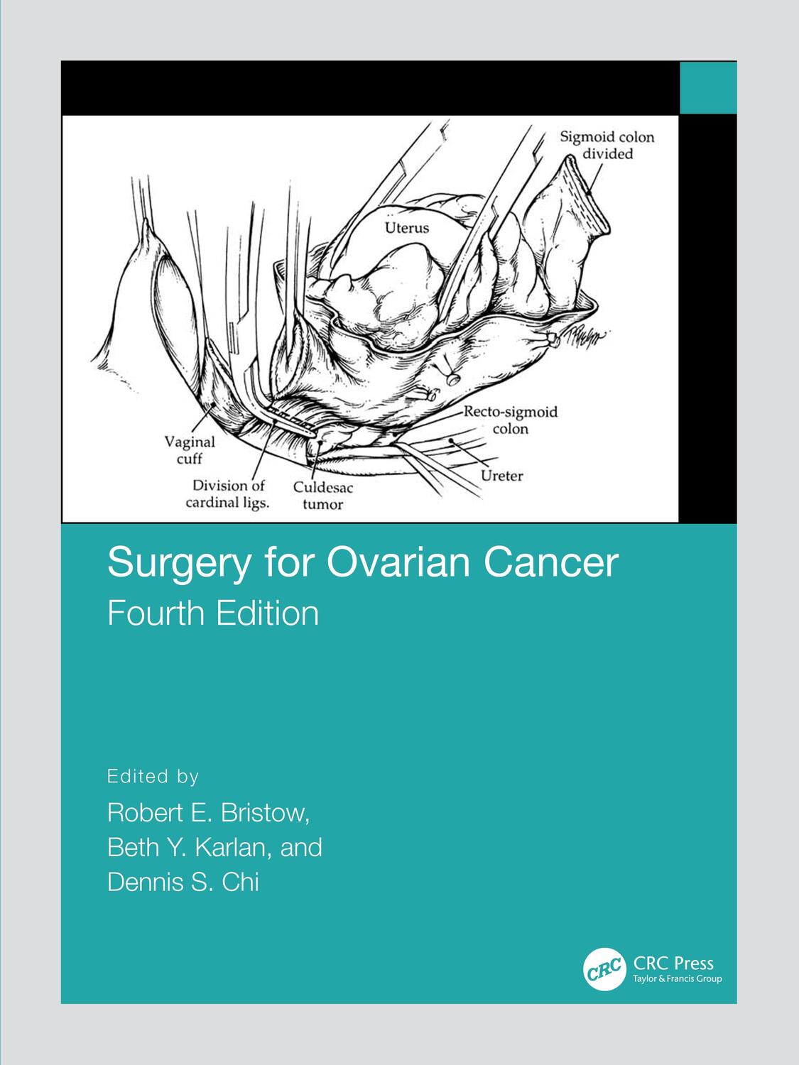 Cover: 9780367150044 | Surgery for Ovarian Cancer | Buch | Einband - fest (Hardcover) | 2022