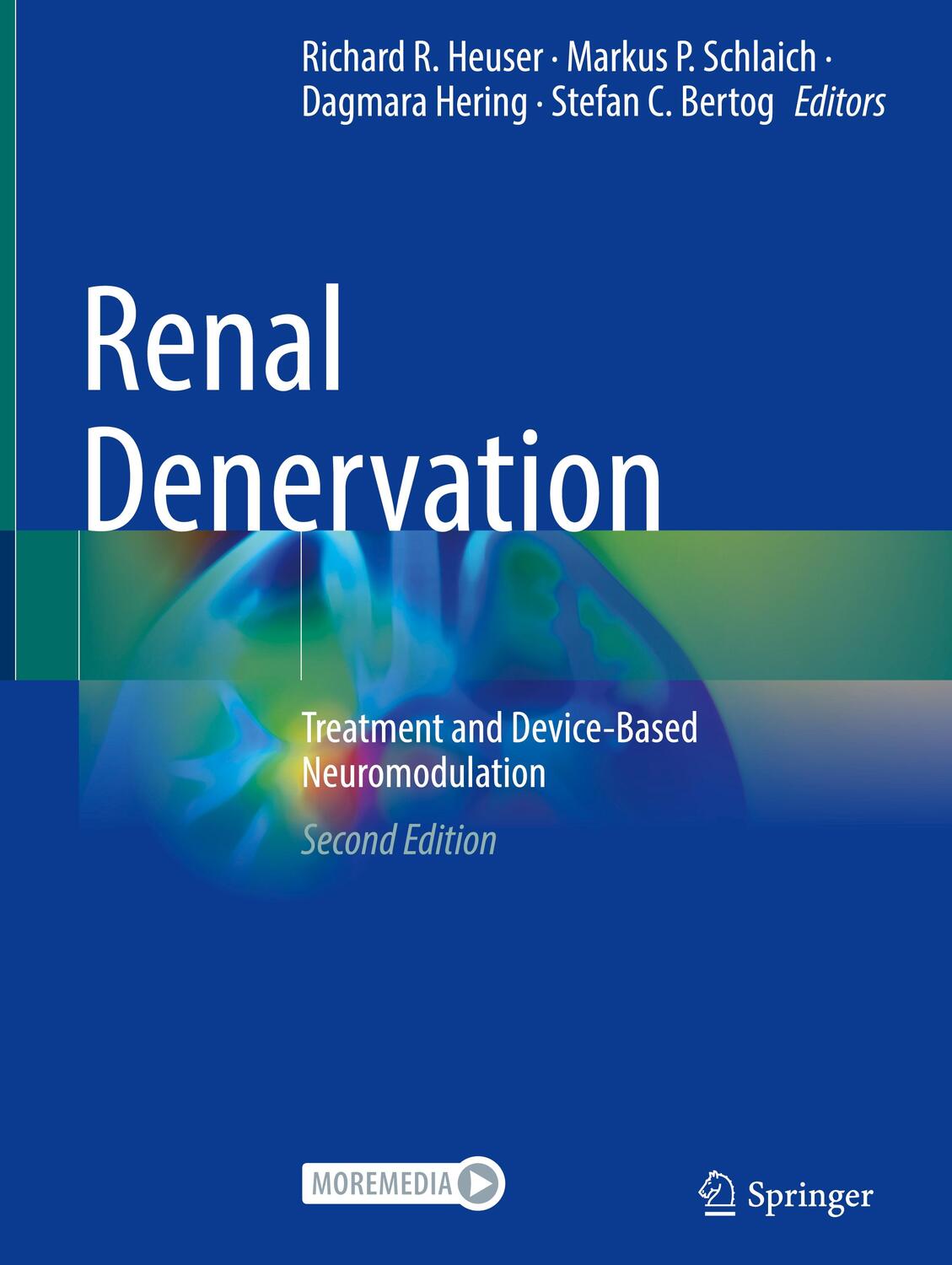 Cover: 9783031389337 | Renal Denervation | Treatment and Device-Based Neuromodulation | Buch