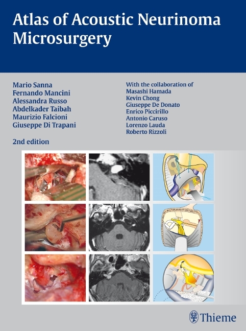 Cover: 9783131102829 | Atlas of Acoustic Neurinoma Microsurgery | Fernando Mancini (u. a.)